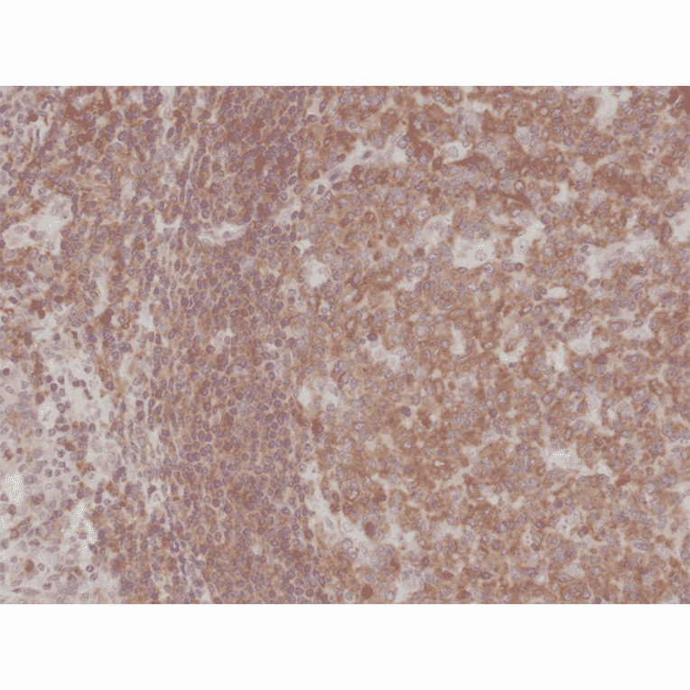 Immunohistochemistry - Anti-NFkB p105 / p50 Antibody [RM299] (A121245) - Antibodies.com