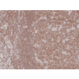 Immunohistochemistry - Anti-NFkB p105 / p50 Antibody [RM299] (A121245) - Antibodies.com