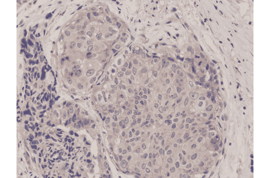 Immunohistochemistry - Anti-mTOR Antibody [RM274] (A121448) - Antibodies.com
