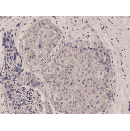 Immunohistochemistry - Anti-mTOR Antibody [RM274] (A121448) - Antibodies.com