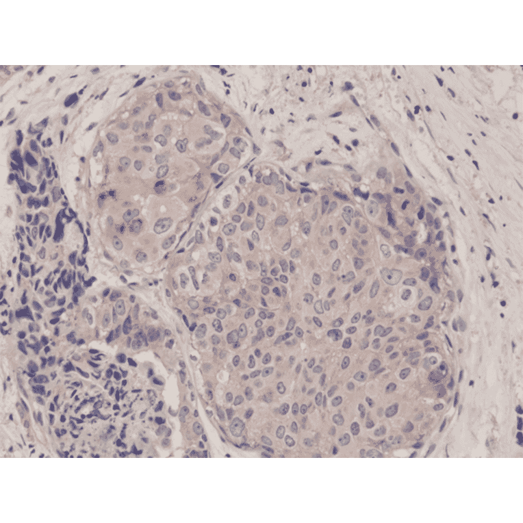 Immunohistochemistry - Anti-mTOR Antibody [RM274] (A121448) - Antibodies.com