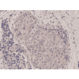 Immunohistochemistry - Anti-mTOR Antibody [RM274] (A121448) - Antibodies.com