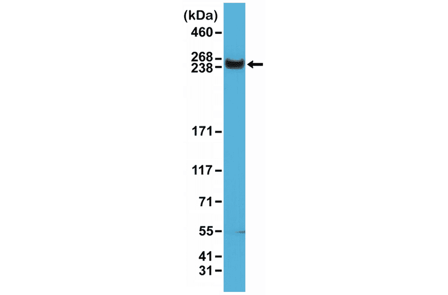 Western Blot - Anti-mTOR Antibody [RM274] (A121387) - Antibodies.com