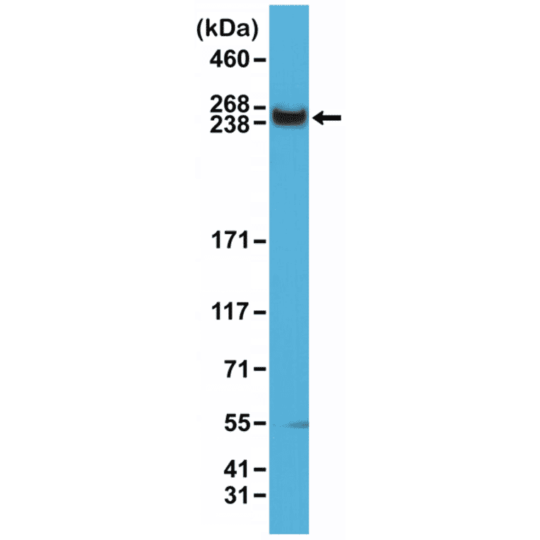 Western Blot - Anti-mTOR Antibody [RM274] (A121387) - Antibodies.com