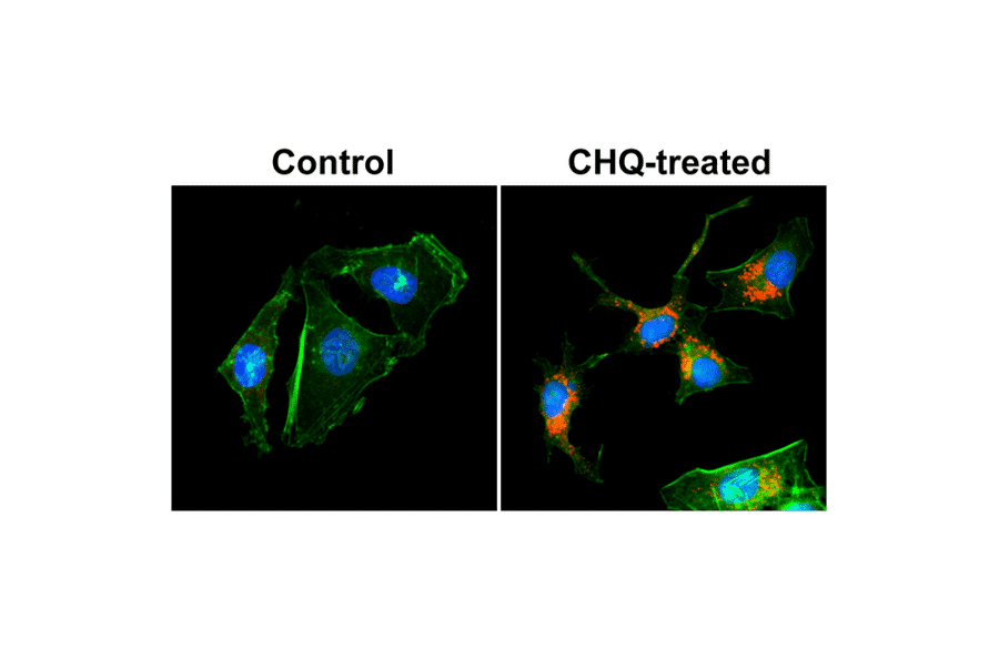 Immunocytochemistry - Anti-LC3B Antibody [RM293] (A121416) - Antibodies.com