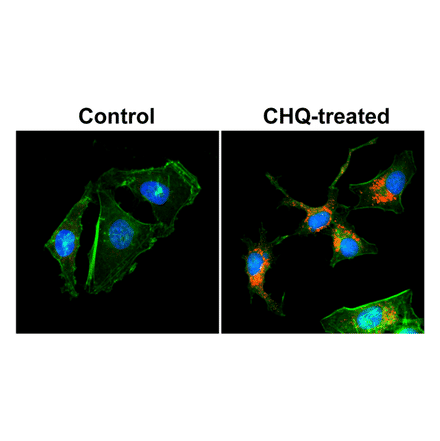 Immunocytochemistry - Anti-LC3B Antibody [RM293] (A121416) - Antibodies.com