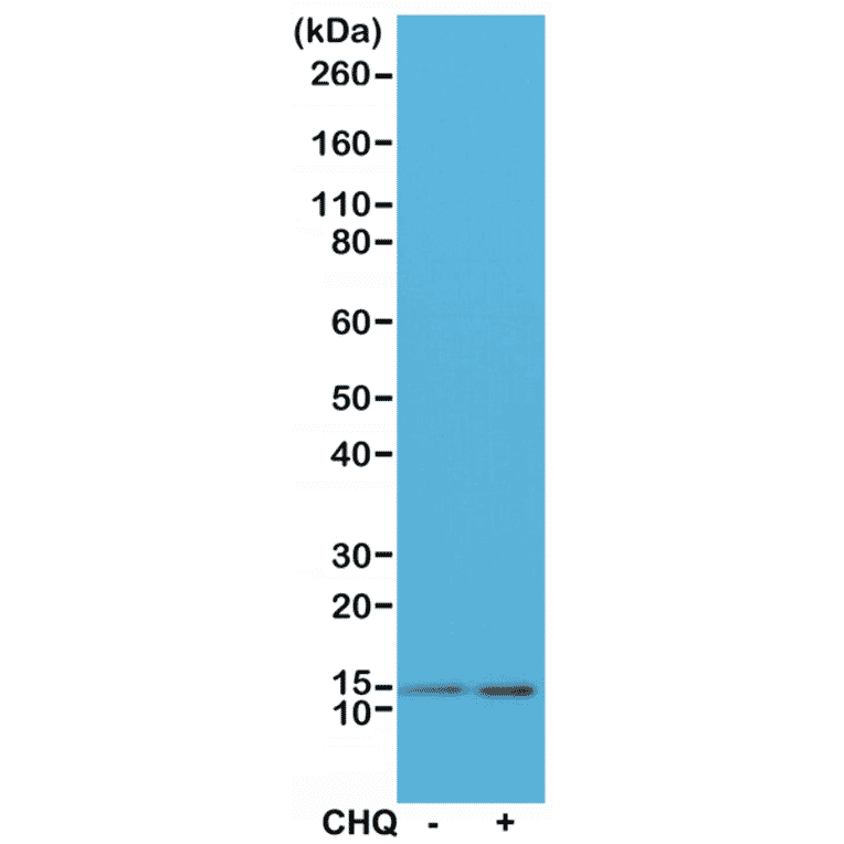 Western Blot - Anti-LC3B Antibody [RM293] (A121388) - Antibodies.com