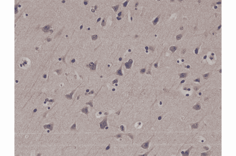 Immunohistochemistry - Anti-LC3B Antibody [RM293] (A121388) - Antibodies.com