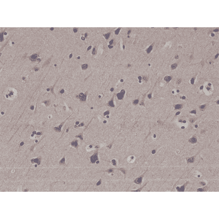 Immunohistochemistry - Anti-LC3B Antibody [RM293] (A121388) - Antibodies.com