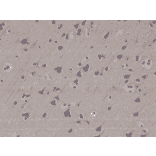 Immunohistochemistry - Anti-LC3B Antibody [RM293] (A121388) - Antibodies.com