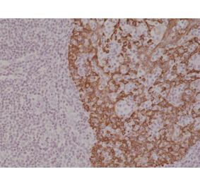 Immunohistochemistry - Anti-Cytokeratin 14 Antibody [RM328] (A121389) - Antibodies.com