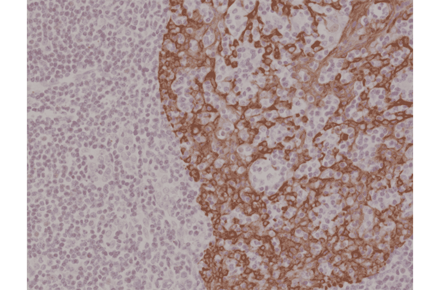 Immunohistochemistry - Anti-Cytokeratin 14 Antibody [RM328] (A121389) - Antibodies.com