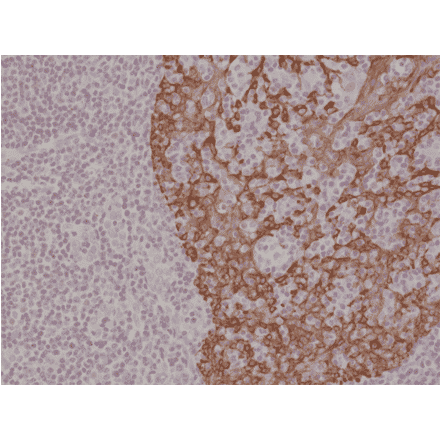 Immunohistochemistry - Anti-Cytokeratin 14 Antibody [RM328] (A121389) - Antibodies.com