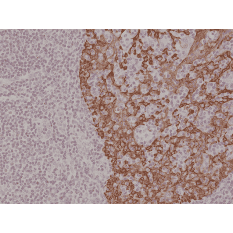 Immunohistochemistry - Anti-Cytokeratin 14 Antibody [RM328] (A121389) - Antibodies.com
