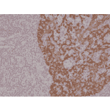 Immunohistochemistry - Anti-Cytokeratin 14 Antibody [RM328] (A121389) - Antibodies.com