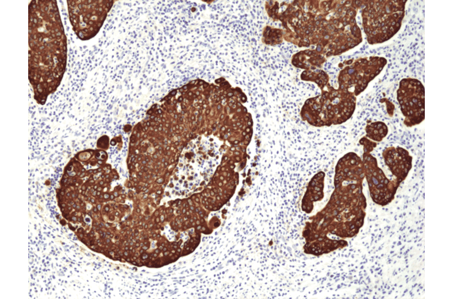 Immunohistochemistry - Anti-Cytokeratin 14 Antibody [RM328] (A121436) - Antibodies.com