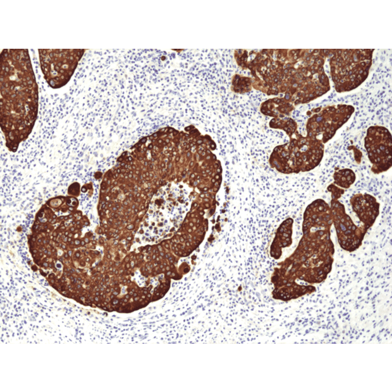 Immunohistochemistry - Anti-Cytokeratin 14 Antibody [RM328] (A121436) - Antibodies.com