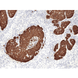 Immunohistochemistry - Anti-Cytokeratin 14 Antibody [RM328] (A121436) - Antibodies.com