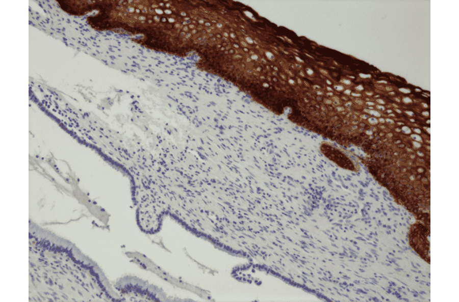 Immunohistochemistry - Anti-Cytokeratin 14 Antibody [RM328] (A121389) - Antibodies.com