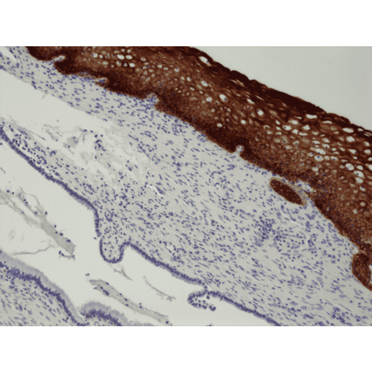 Immunohistochemistry - Anti-Cytokeratin 14 Antibody [RM328] (A121389) - Antibodies.com