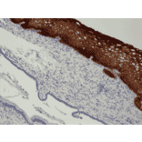 Immunohistochemistry - Anti-Cytokeratin 14 Antibody [RM328] (A121389) - Antibodies.com