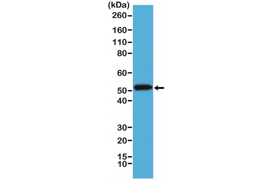 Western Blot - Anti-Cytokeratin 14 Antibody [RM328] (A121389) - Antibodies.com