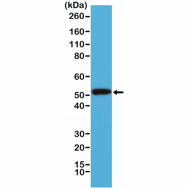 Western Blot - Anti-Cytokeratin 14 Antibody [RM328] (A121389) - Antibodies.com