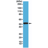 Western Blot - Anti-Cytokeratin 14 Antibody [RM328] (A121389) - Antibodies.com