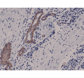 Immunohistochemistry - Anti-CD146 Antibody [RM249] (A121485) - Antibodies.com