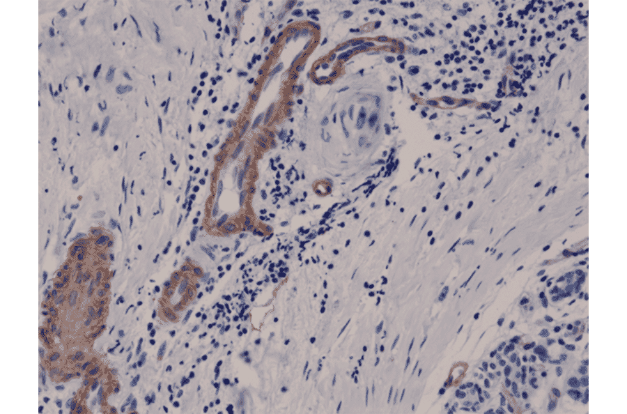 Immunohistochemistry - Anti-CD146 Antibody [RM249] (A121485) - Antibodies.com