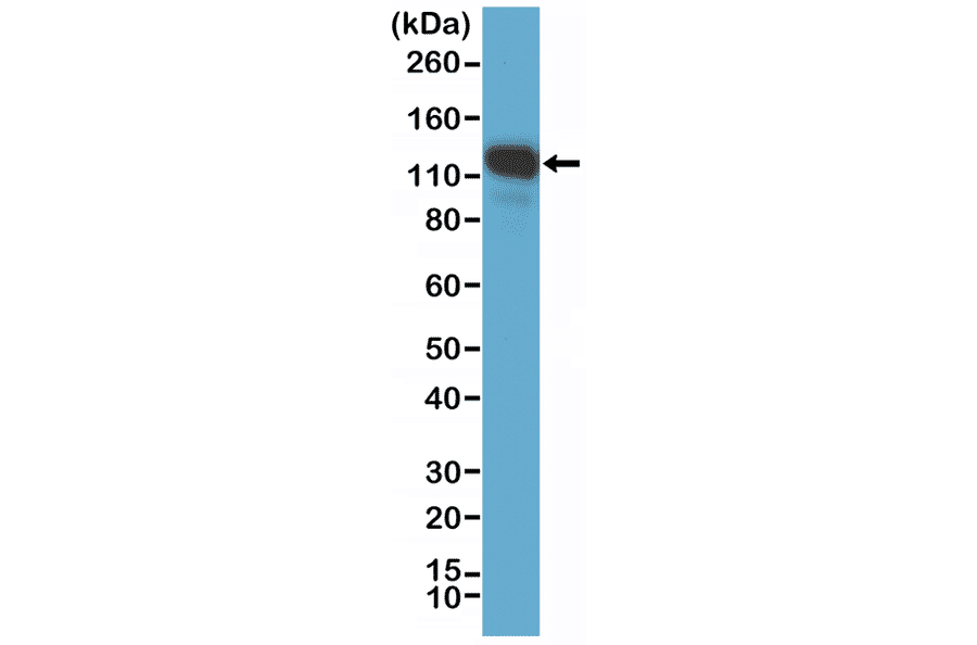 Western Blot - Anti-CD146 Antibody [RM249] (A121391) - Antibodies.com