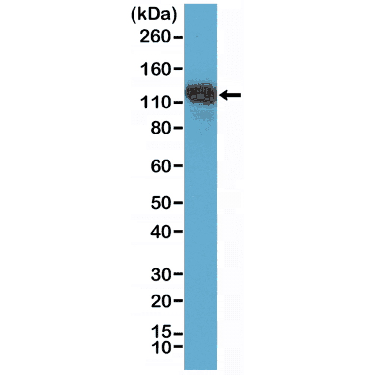 Western Blot - Anti-CD146 Antibody [RM249] (A121391) - Antibodies.com