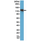 Western Blot - Anti-CD146 Antibody [RM249] (A121391) - Antibodies.com