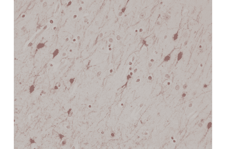 Immunohistochemistry - Anti-Calretinin Antibody [RM324] (A121368) - Antibodies.com