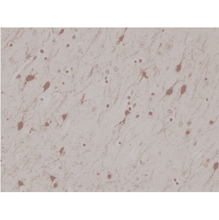 Immunohistochemistry - Anti-Calretinin Antibody [RM324] (A121368) - Antibodies.com
