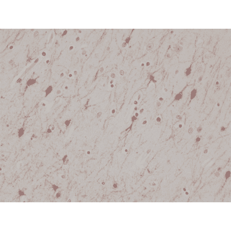 Immunohistochemistry - Anti-Calretinin Antibody [RM324] (A121368) - Antibodies.com