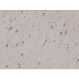 Immunohistochemistry - Anti-Calretinin Antibody [RM324] (A121368) - Antibodies.com