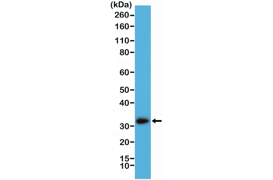 Western Blot - Anti-Calretinin Antibody [RM324] (A121392) - Antibodies.com