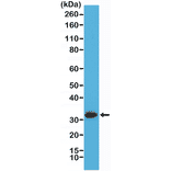 Western Blot - Anti-Calretinin Antibody [RM324] (A121392) - Antibodies.com
