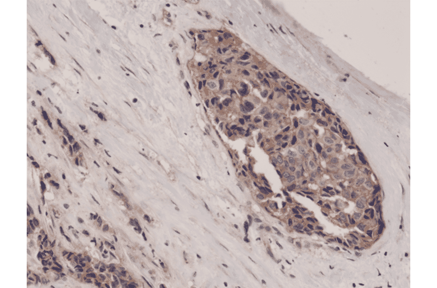 Immunohistochemistry - Anti-beta Catenin Antibody [RM276] (A121417) - Antibodies.com