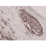 Immunohistochemistry - Anti-beta Catenin Antibody [RM276] (A121417) - Antibodies.com