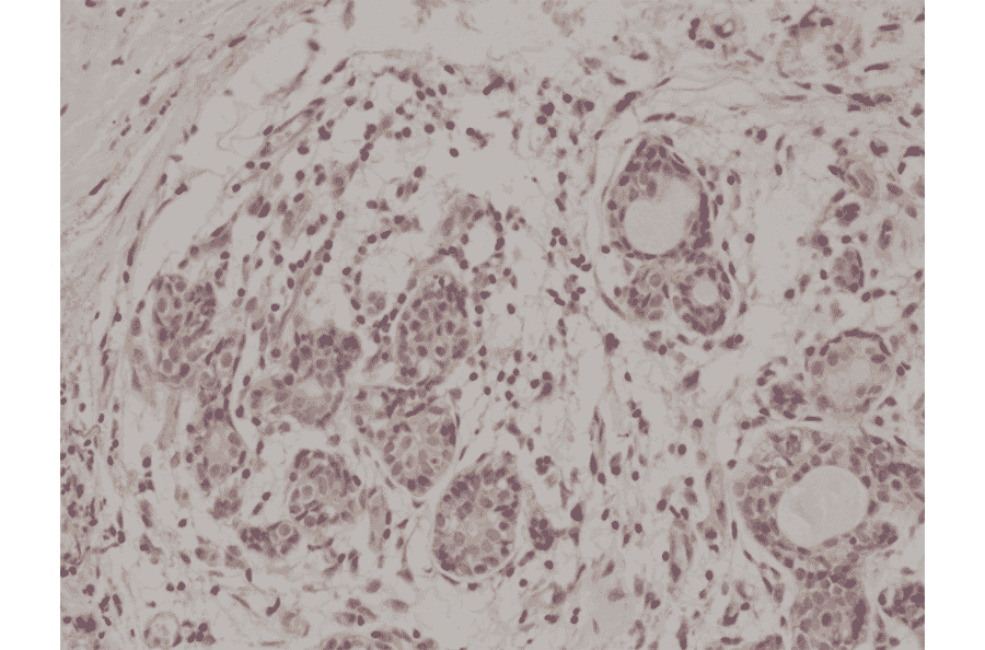 Immunohistochemistry - Anti-AKT Antibody [RM316] (A121372) - Antibodies.com