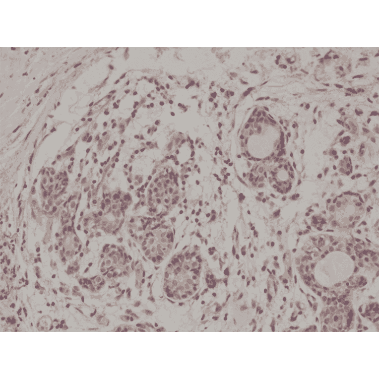 Immunohistochemistry - Anti-AKT Antibody [RM316] (A121372) - Antibodies.com