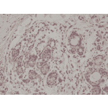 Immunohistochemistry - Anti-AKT Antibody [RM316] (A121372) - Antibodies.com