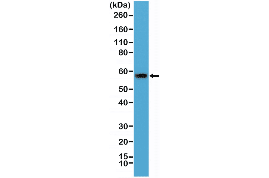 Western Blot - Anti-AKT Antibody [RM316] (A121394) - Antibodies.com