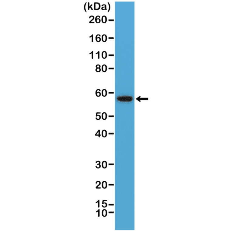 Western Blot - Anti-AKT Antibody [RM316] (A121394) - Antibodies.com