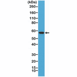 Western Blot - Anti-AKT Antibody [RM316] (A121394) - Antibodies.com