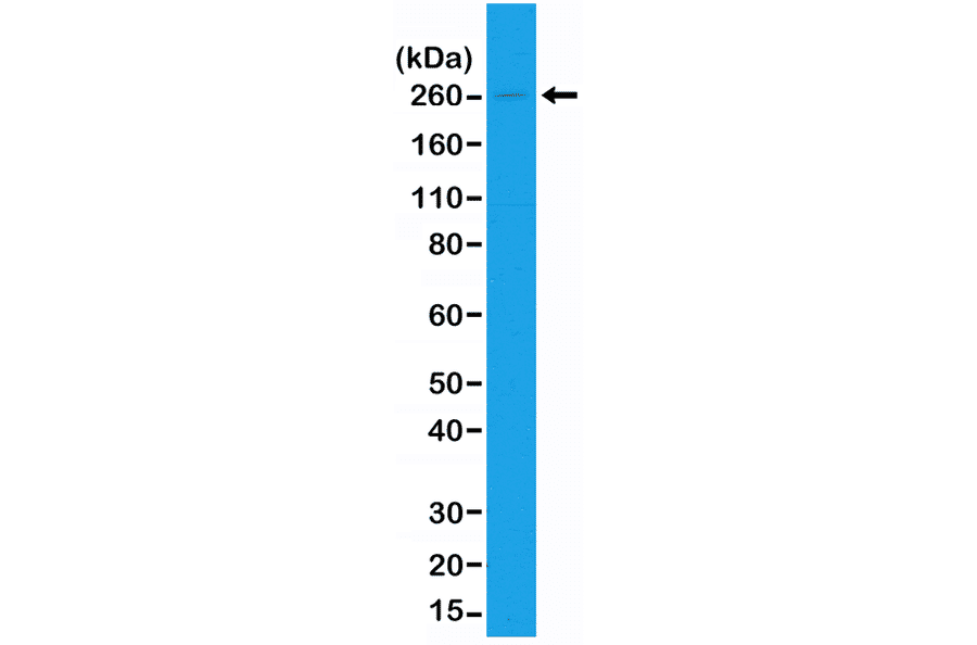 Western Blot - Anti-acetyl CoA Carboxylase Antibody [RM232] (A121395) - Antibodies.com