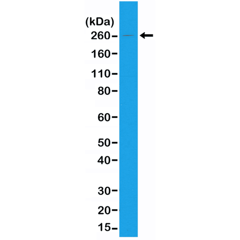 Western Blot - Anti-acetyl CoA Carboxylase Antibody [RM232] (A121395) - Antibodies.com