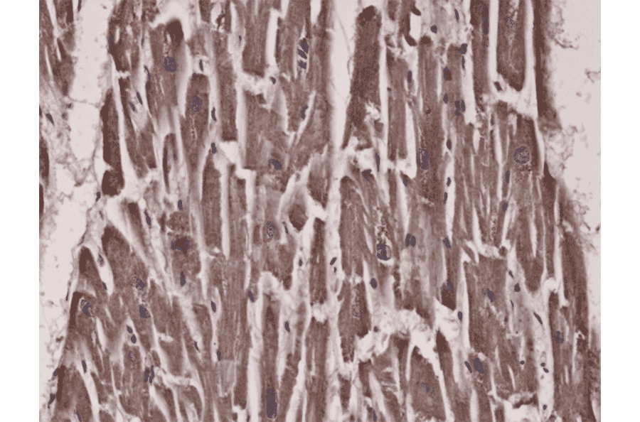 Immunohistochemistry - Anti-acetyl CoA Carboxylase Antibody [RM232] (A121238) - Antibodies.com